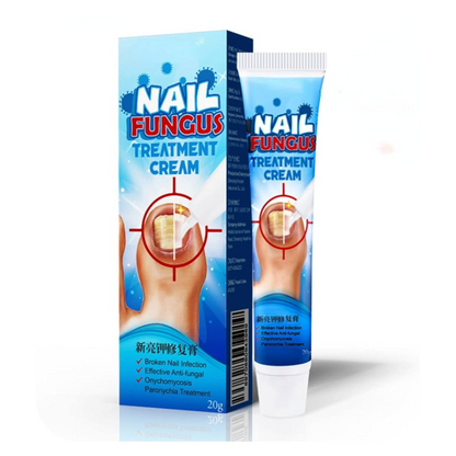 Anti-Fungal Foot Cream | NailFungus
