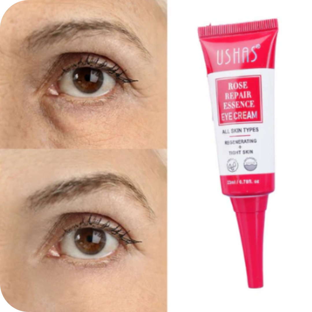 Anti-Dark Circle Eye Contour Cream | Ushas