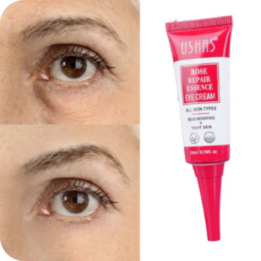 Anti-Dark Circle Eye Contour Cream | Ushas