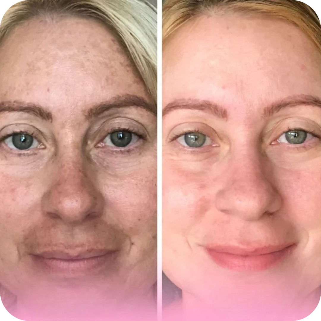 Facial Cleansing & Exfoliating Pads | SkinPads