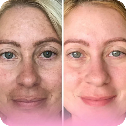 Facial Cleansing & Exfoliating Pads | SkinPads