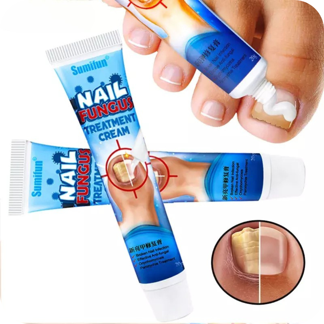 Anti-Fungal Foot Cream | NailFungus