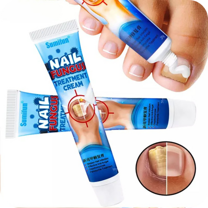 Anti-Fungal Foot Cream | NailFungus