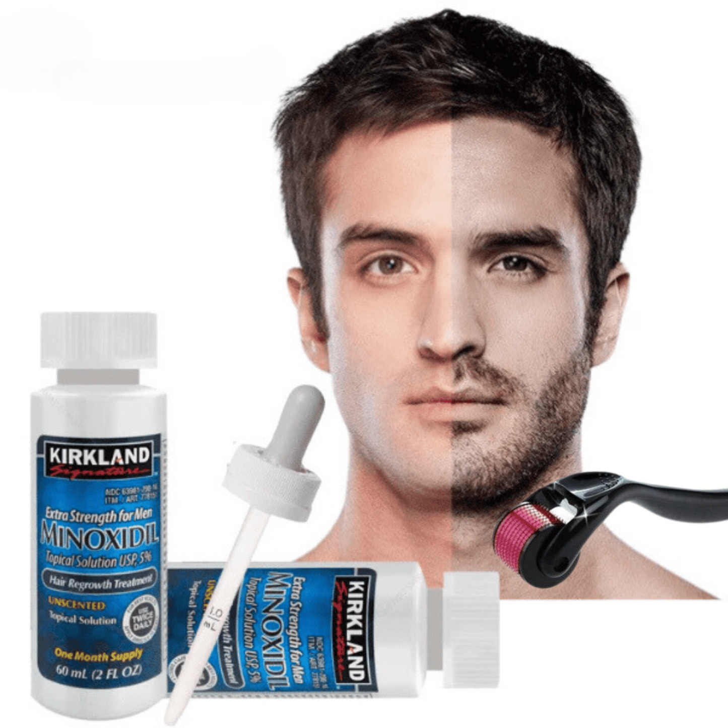Complete Beard & Hair Treatment + Free DermaRoller | MinoxiMen