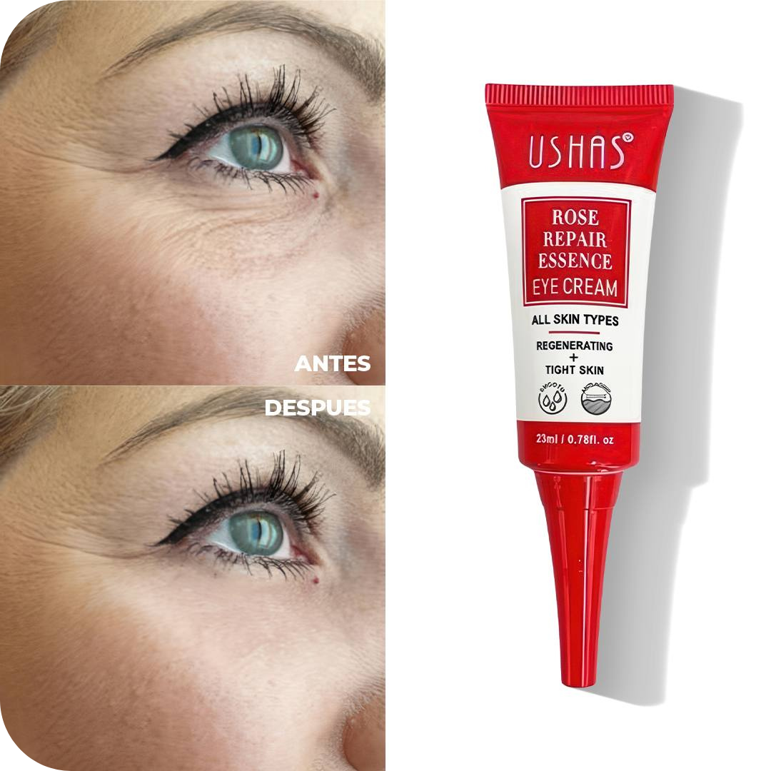 Anti-Dark Circle Eye Contour Cream | Ushas