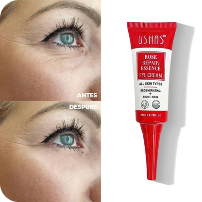 Anti-Dark Circle Eye Contour Cream | Ushas