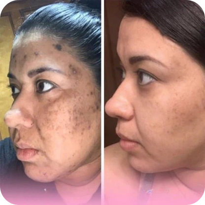 Facial Cleansing & Exfoliating Pads | SkinPads