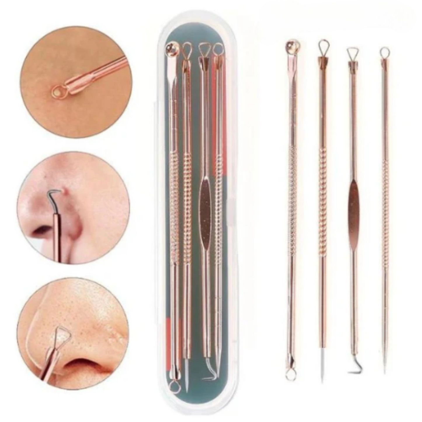 Blackhead Extractor Kit of 4 | DermaClear