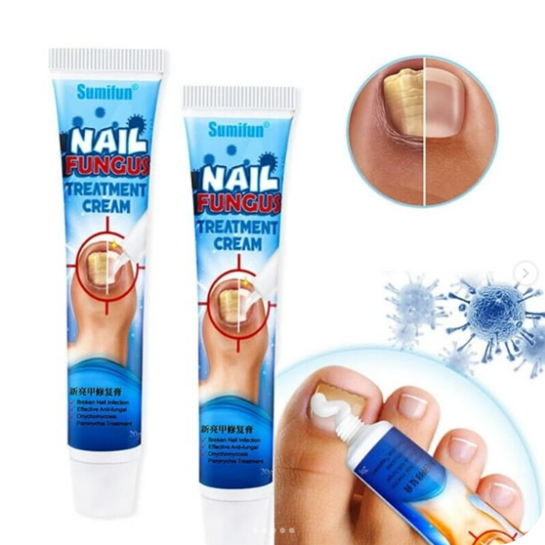 Anti-Fungal Foot Cream | NailFungus