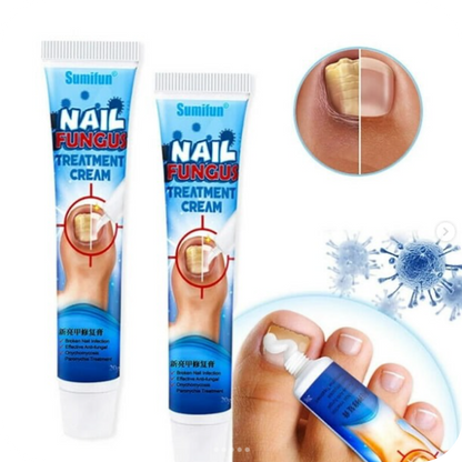 Anti-Fungal Foot Cream | NailFungus