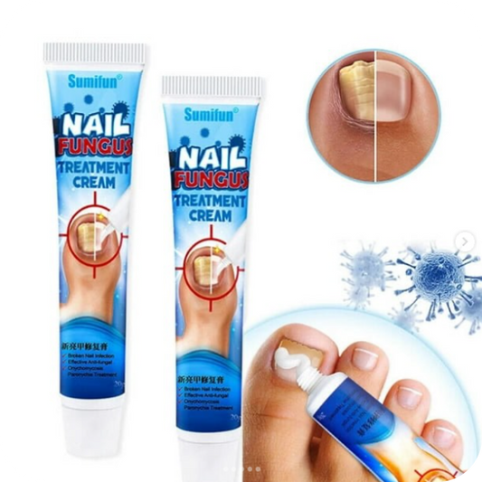 Anti-Fungal Foot Cream | NailFungus
