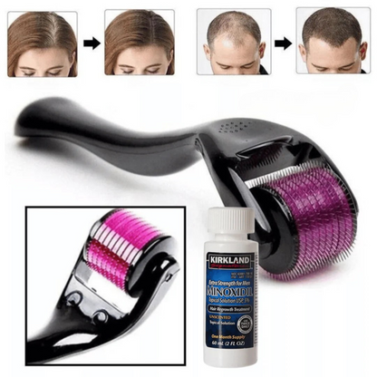 Complete Beard & Hair Treatment + Free DermaRoller | MinoxiMen