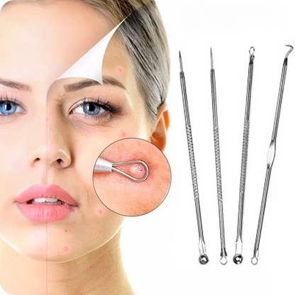 Blackhead Extractor Kit of 4 | DermaClear